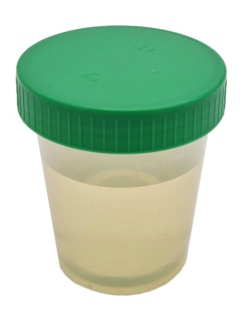 Tiga-Med Bicchieri per urina/campione, 500 pezzi, 125 ml, con tappo a vite verde, graduati fino a 100 ml, scrivibili