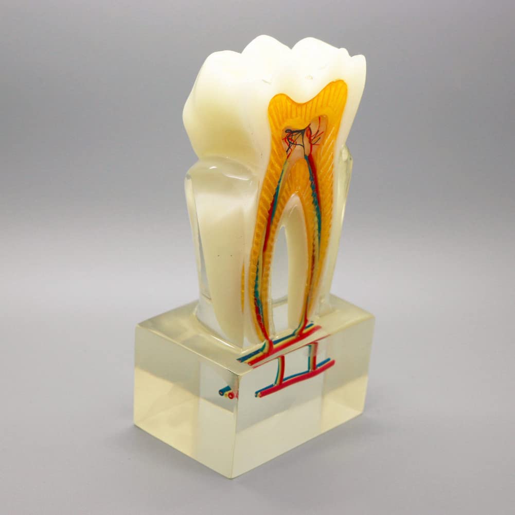 Enseignement des dents détaillé grâce au modèle orthodontique zoomé 6:1