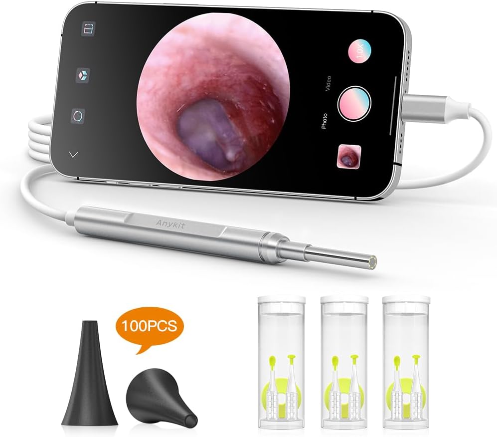 Anykit Digital Otoscope for iPhone, iPad & Android Device