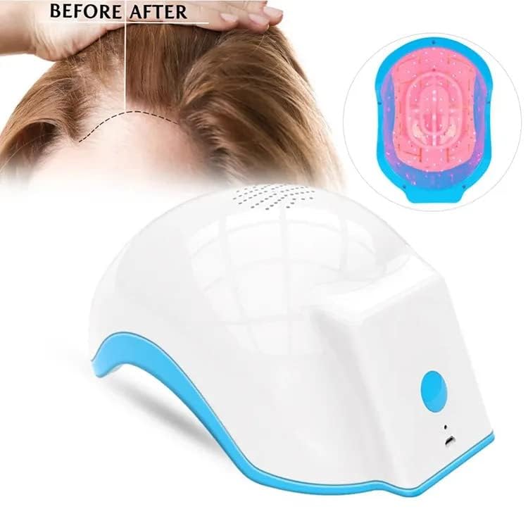 Image of AS-Biomeds LH80 Laser Helmet: Advanced Hair Growth System for Effective Hair Loss Therapy