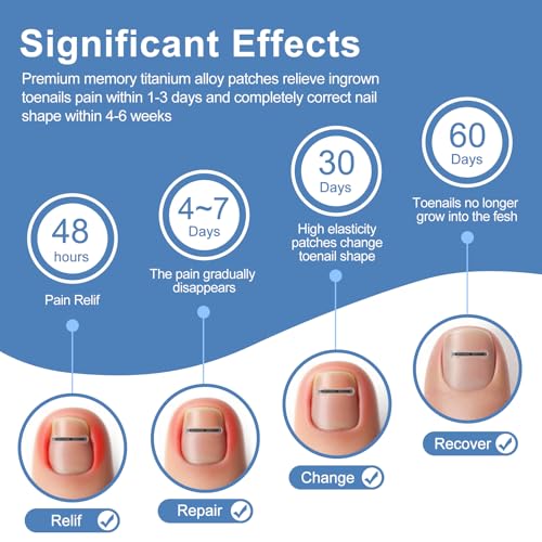 12Pcs Ingrown Toenail Corrector Strips for Curved Toenail Quick Relief,4 Multi-Sizes Ingrown Toenail Treatment Relief Tools Kit for Home Use — view 4
