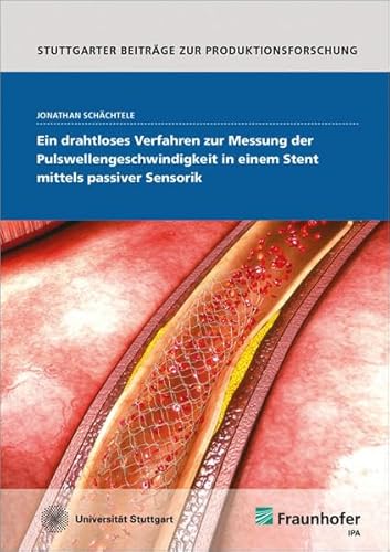Preisvergleich Produktbild Ein drahtloses Verfahren zur Messung der Pulswellengeschwindigkeit in einem Stent mittels passiver Sensorik: Dissertationsschrift (Stuttgarter Beiträge zur Produktionsforschung)