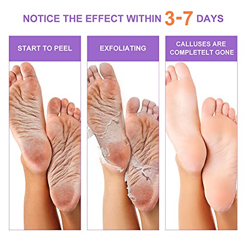 ChainPlus Exfoliating Foot Peel Mask - 3Pcs Skin Remover Natural Treatment For Dead Skin Calluses & Dry Skin - Repair… - Image 6