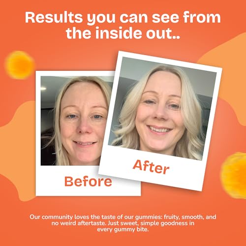 Multivitamin Gummies with Sea Moss for Women + Men by Numoss. Sea Moss 300mg, Green Vegetables Blend 75mg & 15+ Minerals & Vitamins Like Folic Acid, B12, B6, Vitamin D, E & C & Zinc - 60 Gummies - Image 4