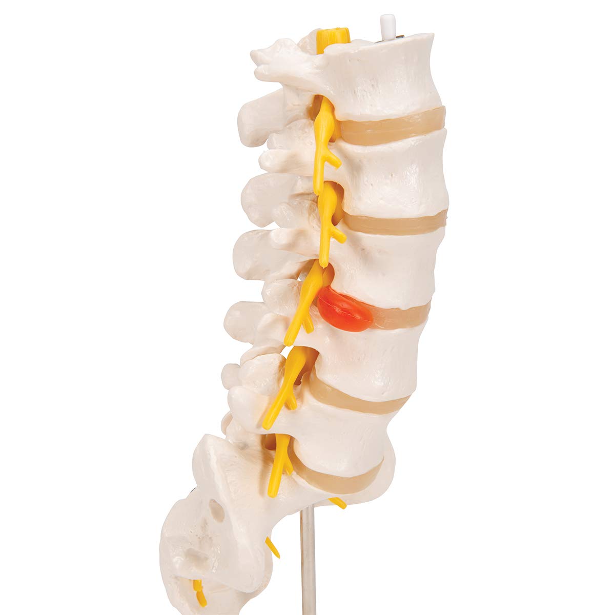 3B Scientific A76/5 Bel Omurga Sütunu, Dorso-Lateral Prolapsed Intervertebral Disk, 34 cm Yükseklik