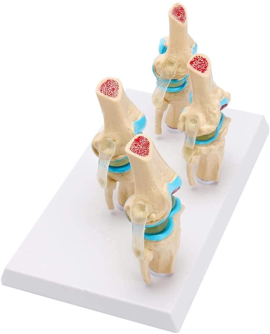 Modele medyczne, ludzki szkielet stawu kolanowego Model anatomiczny nauka medyczna materiały dydaktyczne osteoporoza modele stanu chorobowego 1 zestaw odłączany