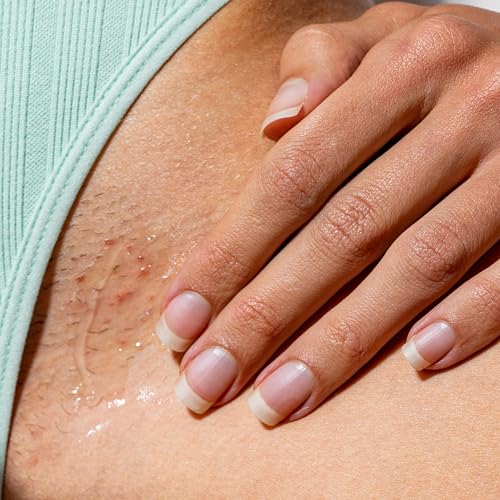 WildMint Spot Soothe Natural Spot Treatment Gel | Reduces Breakouts, Scars & Irritation | Tea Tree Healing Serum for Acne Prone Skin, Blemishes, Redness & Ingrown Hairs | Cruelty-Free UK Skincare 30ml - Image 5