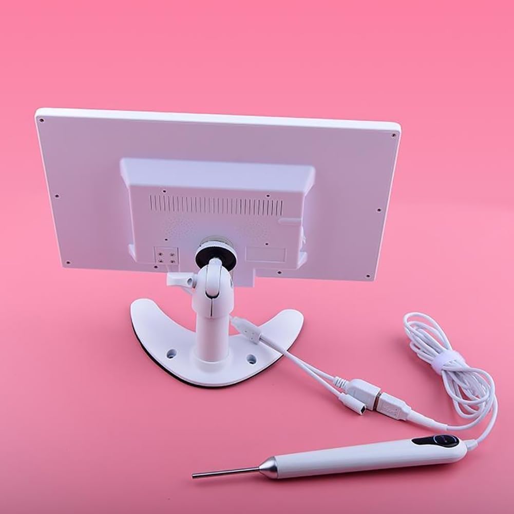 Otoscopio Digital con Pantalla De 10 Pulgadas, Cámara Otoscopio Digital, Herramienta De Eliminación De Cera De Oídos, Puede Tomar Fotografías Y Grabar Pantalla,para Adultos, Niños Y Mascotas