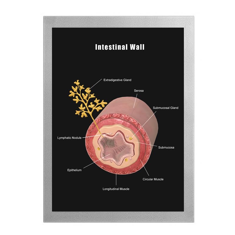 Image of Taanfu Body Educational Learning Anatomy Posters ，Intestine Wall Art Intestinal Villi Anatomy Art Poster Digestive System Organs Illustration Small Intestine Physiology Anatomy Wall Art Villi