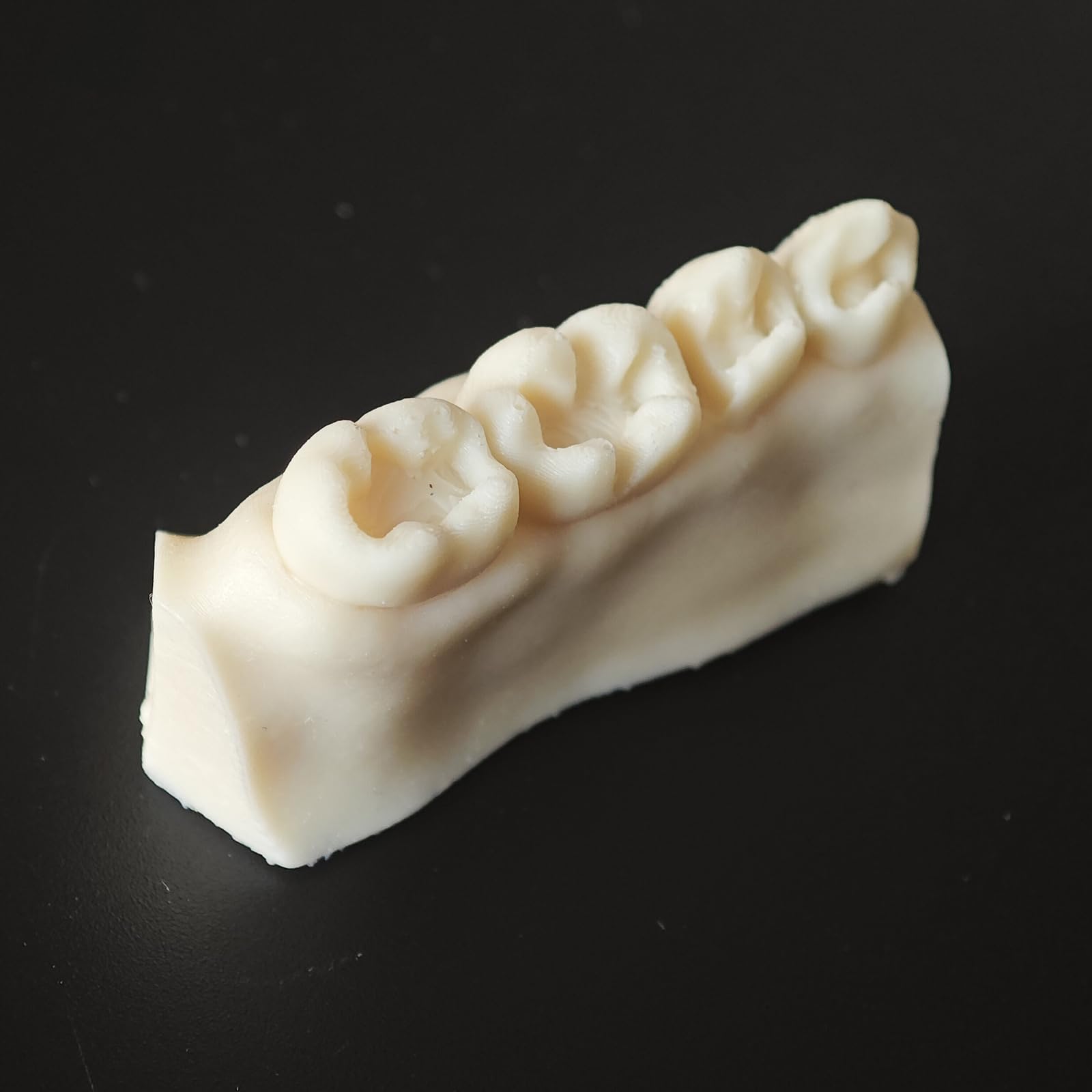 Modello di Pratica per otturazioni dentali in Resina 4 Pezzi Modello di cavità di Classe II Typodont per Studio e insegnamento