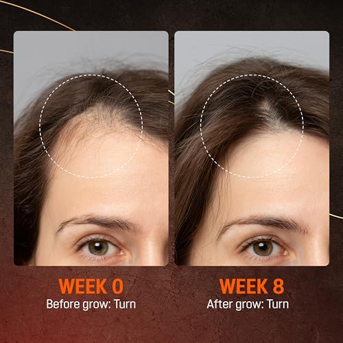 Abera Hair Growth Serum for Hair Loss, Natural Hair Regrowth Treatment for Hair & Beard with Biotin & Maca | Extra Strength & Bigger Size 1.69 fl oz (1 Serum + Gift) — view 4