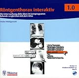 Röntgenthorax interaktiv (CD-ROM): Die Untersuchung aktiv üben mit dem Lernprogramm Befunde vergleichen im Atlas