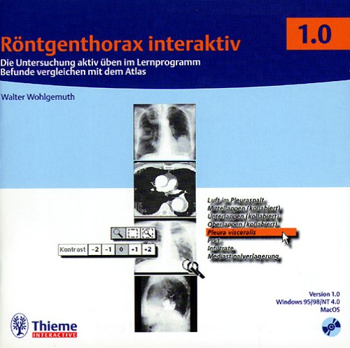 Röntgenthorax interaktiv (CD-ROM): Die Untersuchung aktiv üben mit dem Lernprogramm Befunde vergleichen im Atlas
