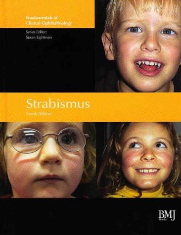 Strabismus: Fundamentals of Clinical Opthalmology