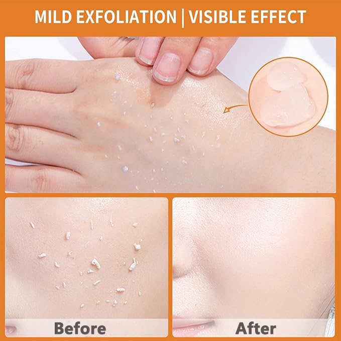 Orange Enzymes Exfoliating Gel, Natural Orange Peeling Gel Face Scrub, Deep Cleansing Moisturizing Facial Exfoliator（2pcs）