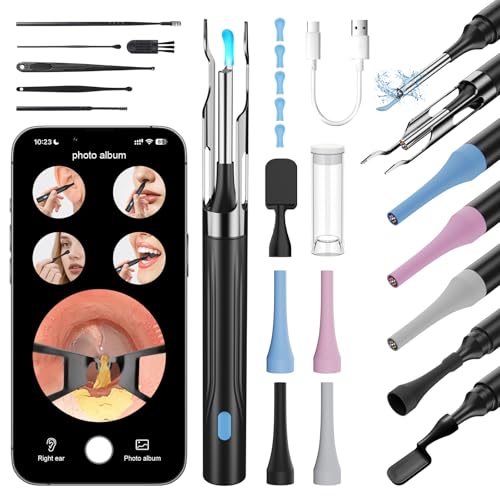 6 in 1 Kamerawerkzeug zur Ohrenschmalzentfernung mit Pinzette, Ear Scope Otoskop Set mit 6 LED Kameralichtern, visueller Ohrpicker, kabelloser Ohrenschmalzentferner (schwarz, DF004)
