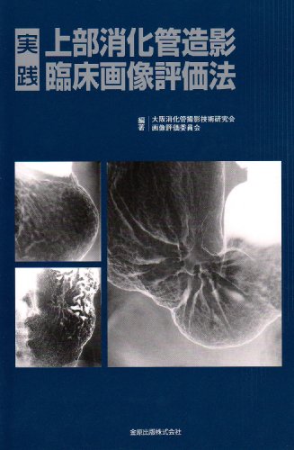 楽天 無料電子書籍 実践 上部消化管造影臨床画像評価法 バイ
