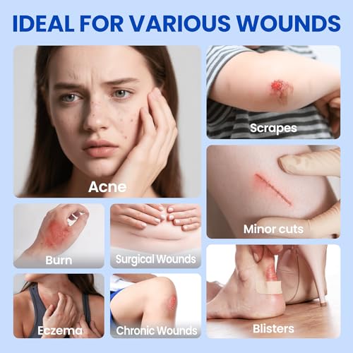 Image of Hydrocolloid Roll Adhesive Bandages Medical Grade Pimple Tape, 2in x 12ft