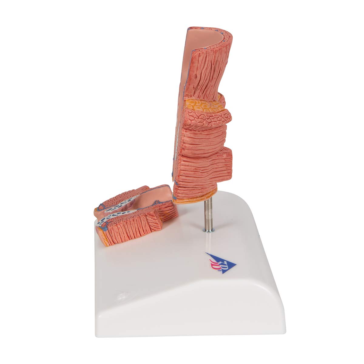 3B Scientific K27 Hemorrhoid Model - 3B Smart Anatomy