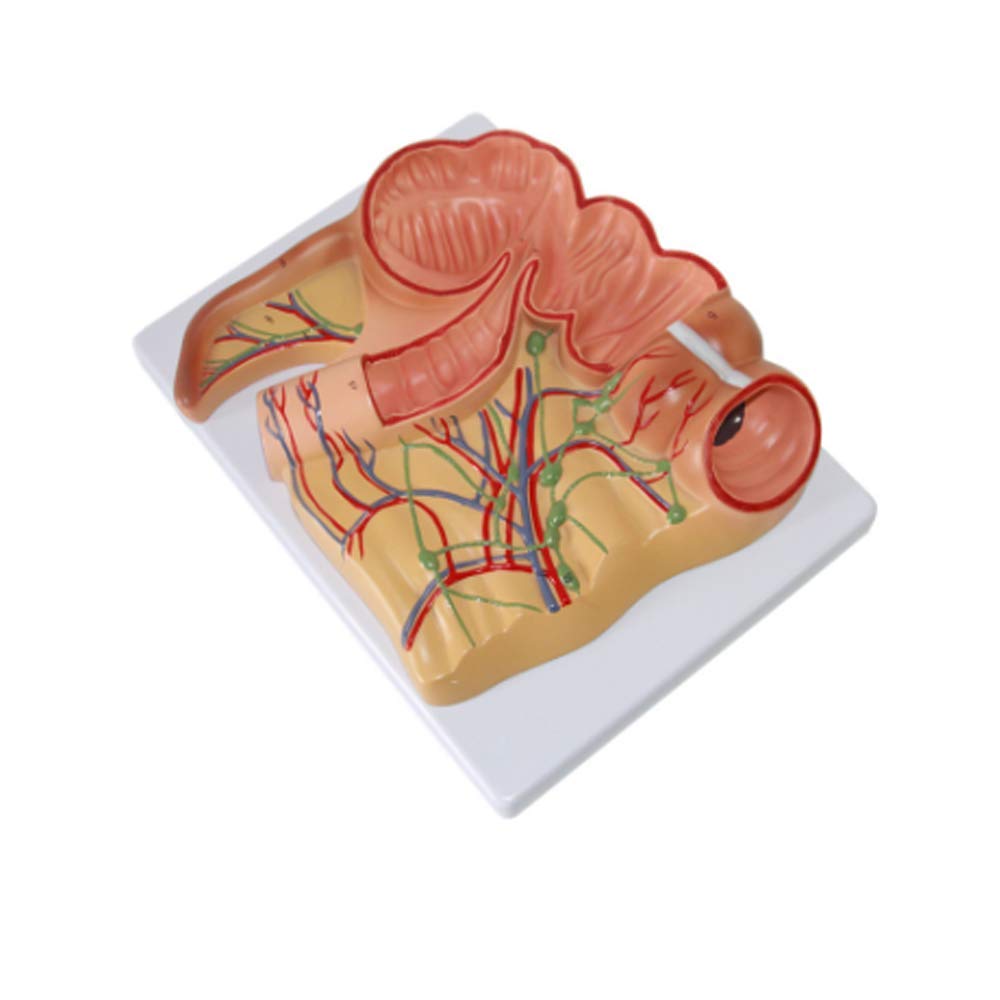 GTHTUHFD Educational Model Human Rectum Appendicitis Lymph Nodes Distribution Model For Medical Study Teaching Aids Doctorpatient Communication Demonstration,Medical Models