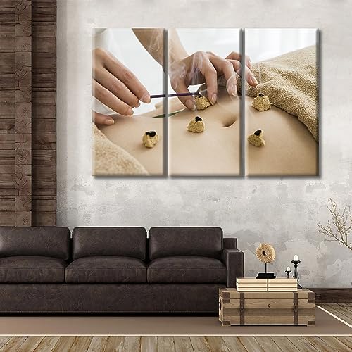 Image of TUMOVO 3 Panels Moxibustion Canvas Wall Art Moxa Moxibustion Posters Paintings for Wall Decorations Nosocomium Artwork Canvas Photo Stretched and Framed Ready to Hang (60 inch Wx40 H)