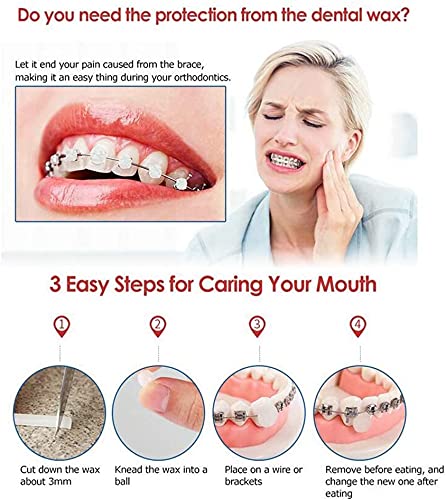 Rzjzgz Dental Oral Care Orthodontics Wax With Fruit Smell For Brace Wearers Flavored Gum Protection (10Pack) #TOP3