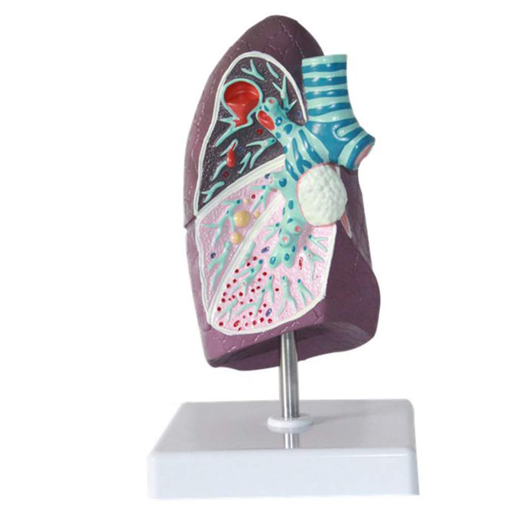 Sjdopulse Black Human Lung Pathology Model - Lung Model Smokers' Visceral Lung Respiratory System Teaching Model - For Study Display Teaching Medical Model,Lab Supplies