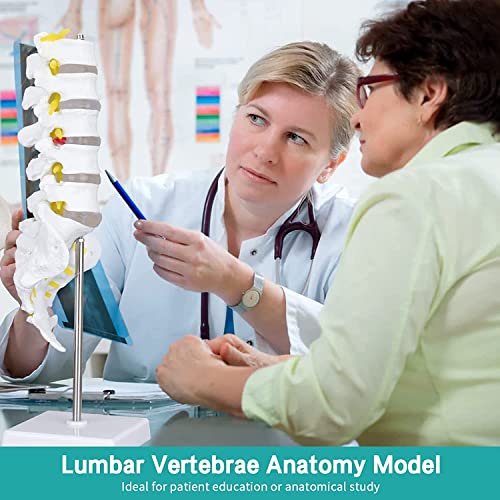 Image of Life Size Lumbar Vertebrae Sacrum Coccyx & Nerves Anatomical Spinal Column for Chiropractor, Medical Students, Teaching & Demonstration