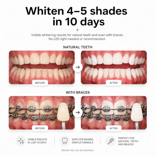 Image of Opalescence Go 15% Mint - Prefilled Teeth Whitening Trays - 5194