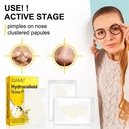 Rtbyue Xl Hydrocolloid Patches, Original Blackhead Remover Strips, Deep Cleansing Nose Strips With Instant Pore Unclogging, 12 Nose Strips, Approved Overnight Strips To Absorb Acne Nose Gunk #TOP5