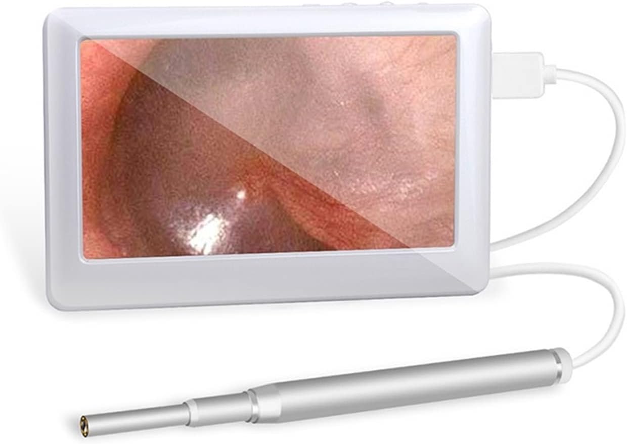 hongmei1 Endoscope Industriel Nettoyage de l'oreille Endoscope 3.9mm