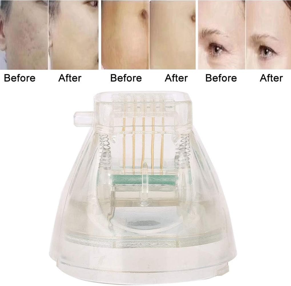 Cartucho de microagujas para máquina de belleza RF, 5 cabezales de repuesto desechables