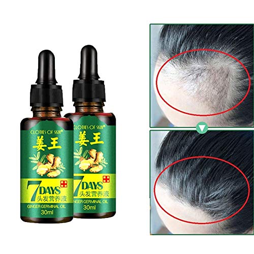 Prettyui Ingwer Germinal Öl Haar Wachstum Ingwer Essential Öl Growth Haar Haarausfall Behandlung Haare Wachstum Serum für Herren und Damen (Ingwer Germinal Öl 2 Flaschen)