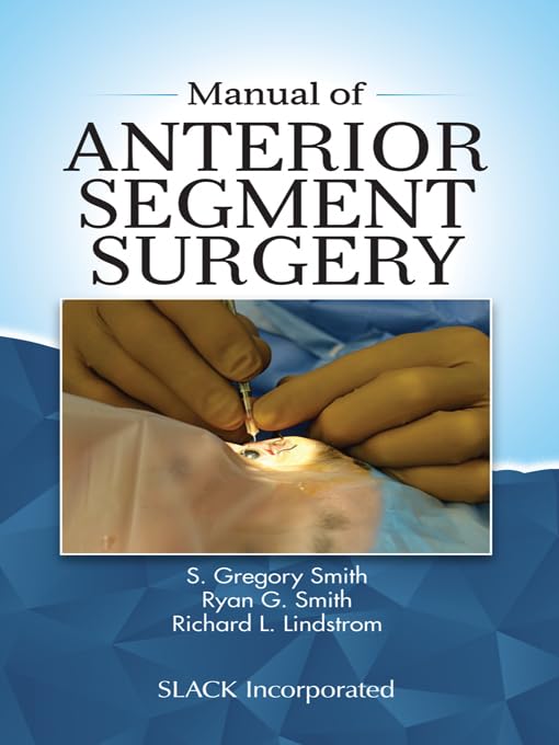 Buy Manual of Anterior Segment Surgery — BookShops.in
