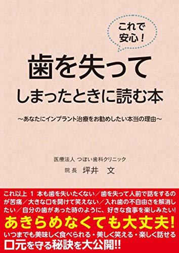 Amazon Co Jp これで安心 歯を失ってしまったときに読む本 あなたにインプラント治療をお勧めしたい本当の理由 Ebook 坪井 文 名古屋 肇 本 Amazon Co Jp これで安心 歯を失ってしまったときに読む本 あなたにインプラント治療をお勧めしたい本当の理由 Ebook 坪井 文 名古屋 肇 本