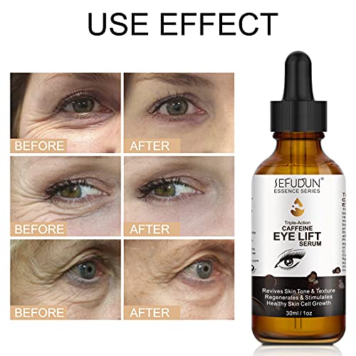 Caffeine Eye Serum With Egcg, Collagen - Anti Aging Eye Treatment Serums For Women & Men - Reduces Puffiness, Dark Circles, Under Eye Bags, Wrinkles And Fine Lines Around The Eyes (1 Oz / 30 Ml) #TOP4
