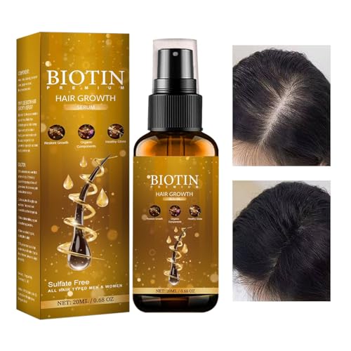 Aceite esencial para el cabello con biotina - Aceite esencial para el crecimiento del cabello - Esencia suavizante del cabello, fortalece el folículo piloso, esencia de biotina de 0,68 oz para Kasmole