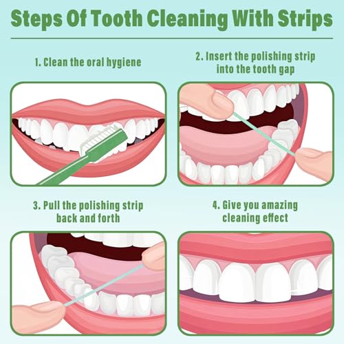 dental polishing strips sanding strips tooth file teeth sanding grinding tool 3 rolls