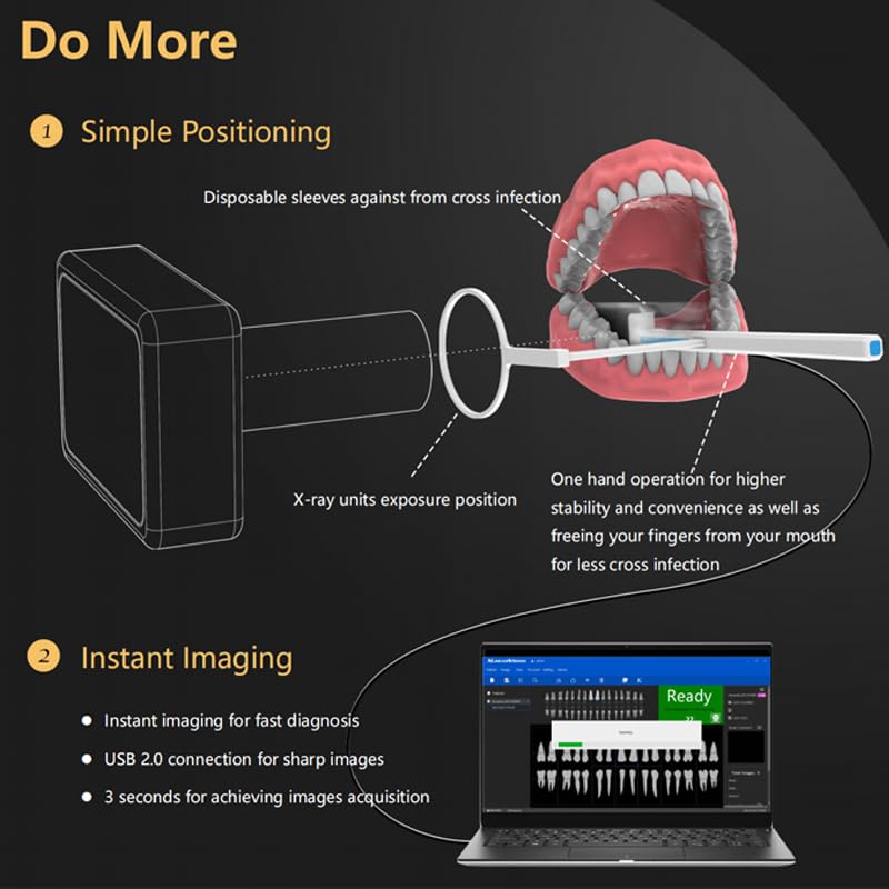 Dental X-Ray Sensor Veterinary Radiovisograph HD Digital Intraoral Imaging System Portable X Ray Digital Sensor (1.5 (25x30mm))