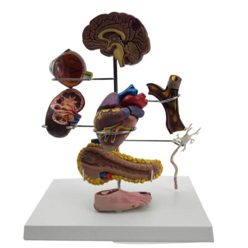 Modèle organe diabétique AMITD 8 parties avec détails anatomiques des lésions glycémiques