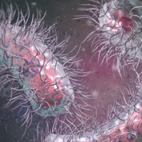 11: Rising Threat of NDM-CRE: CDC Epidemiologist Highlights Urgent Infection Prevention Priorities