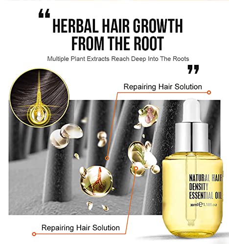 Pure-Natural-Hair-Density-Essential-Oil-Hovo-Hair-Density-Essential-Oil-Ginger-Essence-Hair-Growth-Oil-Hair-Regrowth-Essential-Oil-Natural-Hair-Regrowth-Serum-For-Women-Men-2PCS