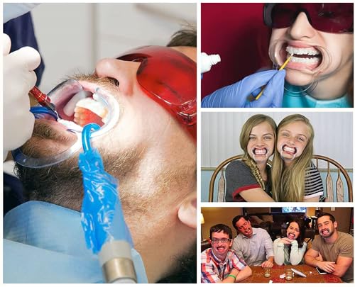 LATRAT 12 Stück Einweg-Dentaldehner C-Form Öffner, Dental Extender Retraktor Mund für Oralinspektion, Zahnaufhellung, Kauen, Wörter für Familienspiele (transparent)