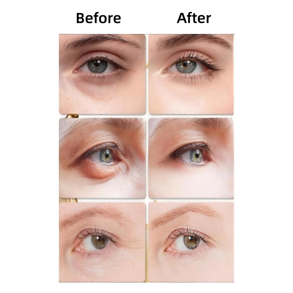 Snake Peptide Eye Cream with Massage Roller, Caffeine Reduce Eye Wrinkles Dark Circles, Anti-Aging Eye Cream for Dark Circles, Puffiness & Wrinkles, Hydrating - Image 4