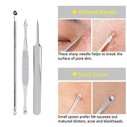 Blackhead Remover Tool, Aooeou Professional Pimple Popper Tool Kit - Easy Removal For Blemish, Whitehead Popping, Zit Removing For Risk Free Nose Face, Anti-Slip Coating Handle (B-Silver) #TOP3