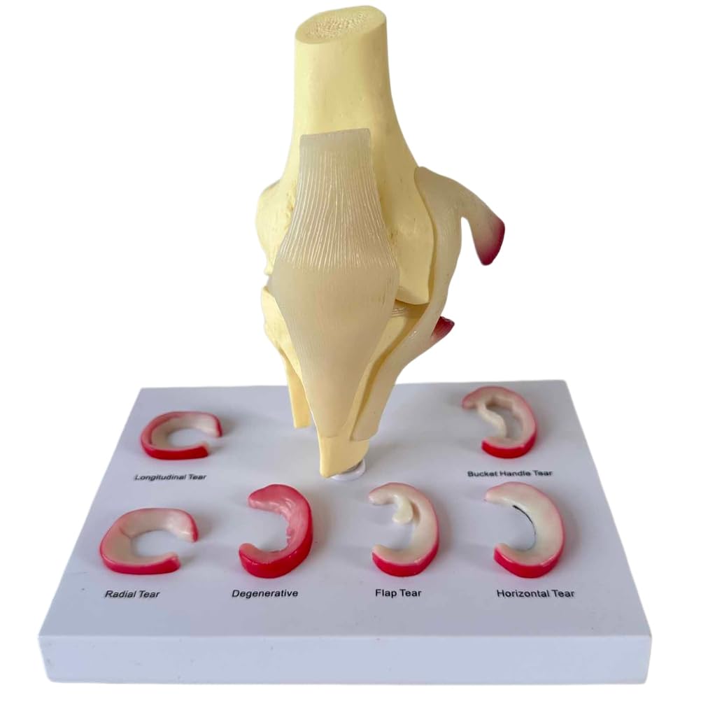 Modelo de articulación de Rodilla Humana Modelo de lesión de menisco Modelo de reparación de ligamento de Rodilla
