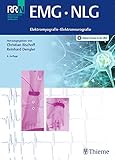 EMG NLG: Elektromyografie - Nervenleitungsuntersuchungen
