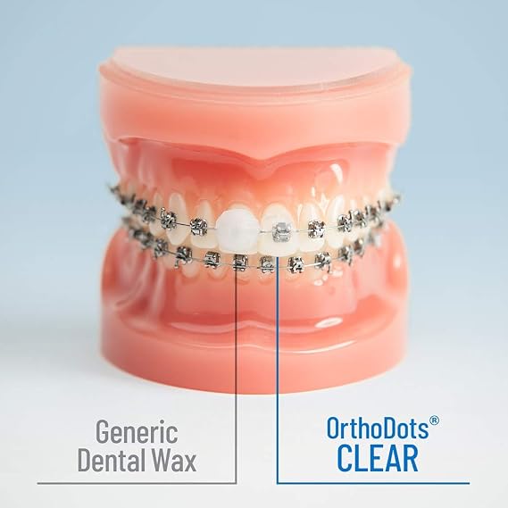 OrthoDots CLEAR 24-Hour Protection | Sticks Better than Dental Wax | Moisture Activated Braces Wax Alternative for Pain Caused by Braces, Clear Aligner Trays, and Other Orthodontic Appliances