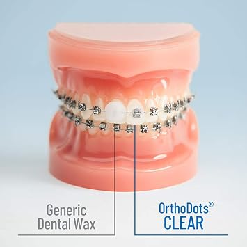 OrthoDots CLEAR 24-Hour Protection | Sticks Better than Dental Wax | Moisture Activated Braces Wax Alternative for Pain Caused by Braces, Clear Aligner Trays, and Other Orthodontic Appliances