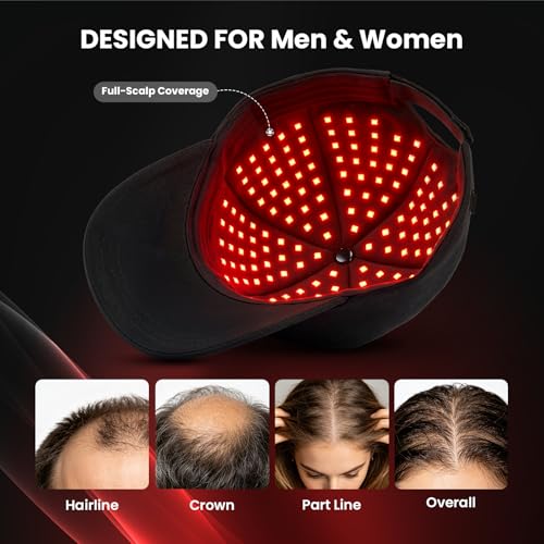 Image of CAYAMA Red Light Hair Growth Cap for Men & Women, 528 Total Light Emitters, Full-Scalp Coverage, 660nm Red Light + NIR, Adjustable Fit, At-Home Scalp Care